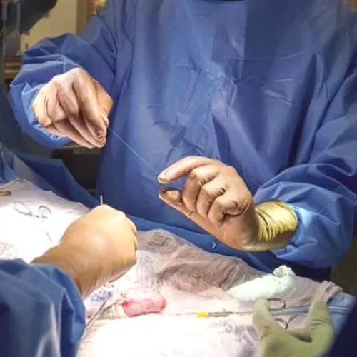 Hospital de Urgências de Sergipe recebe autorização para realizar transplante de pele