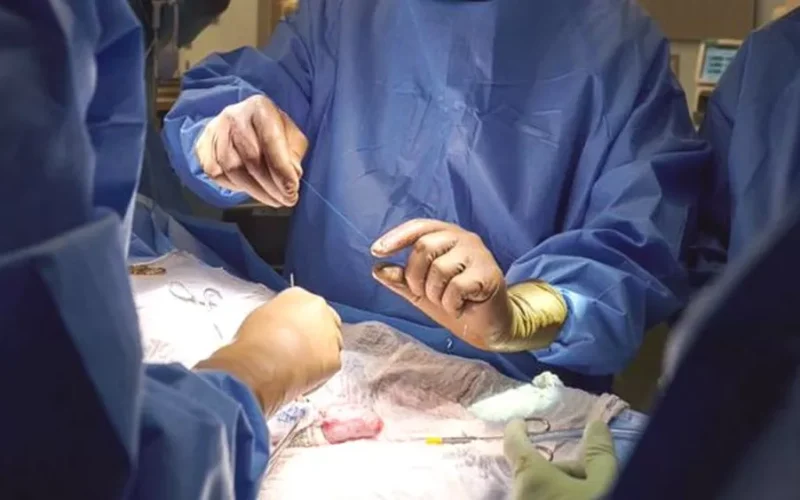 Hospital de Urgências de Sergipe recebe autorização para realizar transplante de pele